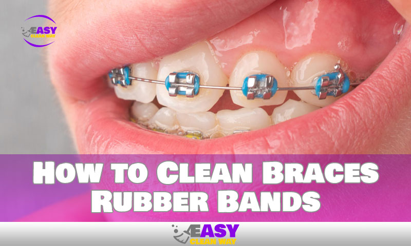 How to Clean Braces Rubber Bands